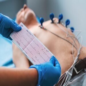Ecocardiograma