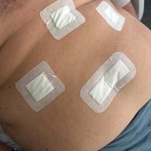 post operatorio bariatrica